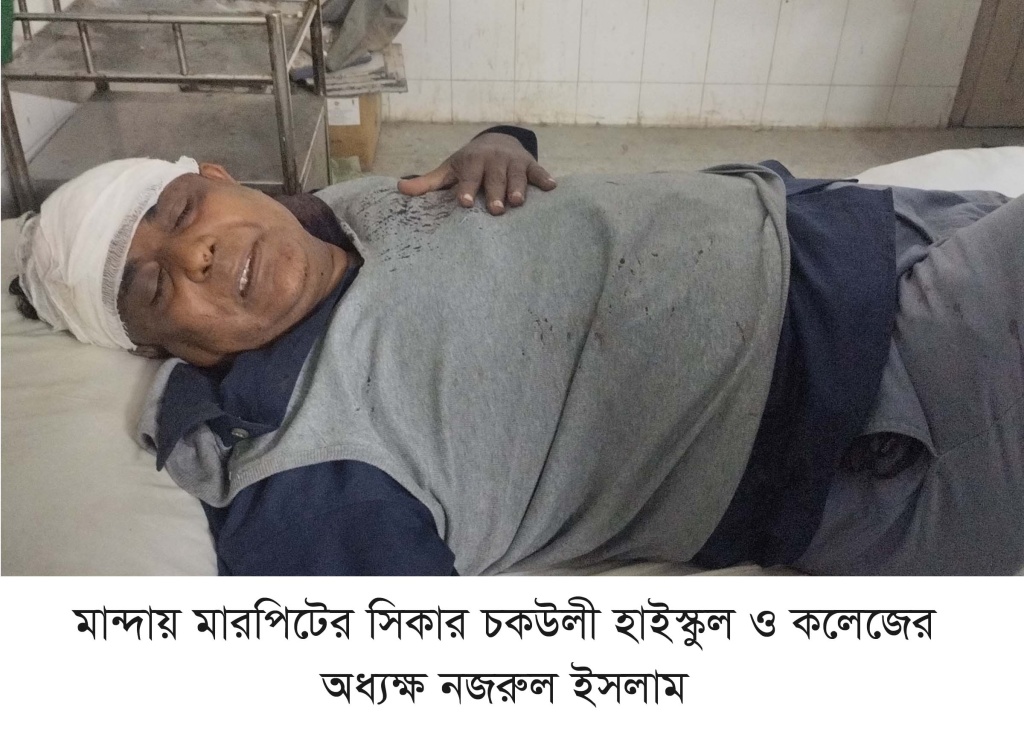 মান্দায় নিয়োগকে কেন্দ্র করে মারধরের শিকার হলেন এক অধ্যক্ষ