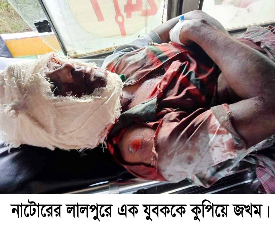 প্রেমিককে কুপিয়ে জখম করল প্রেমিকা!