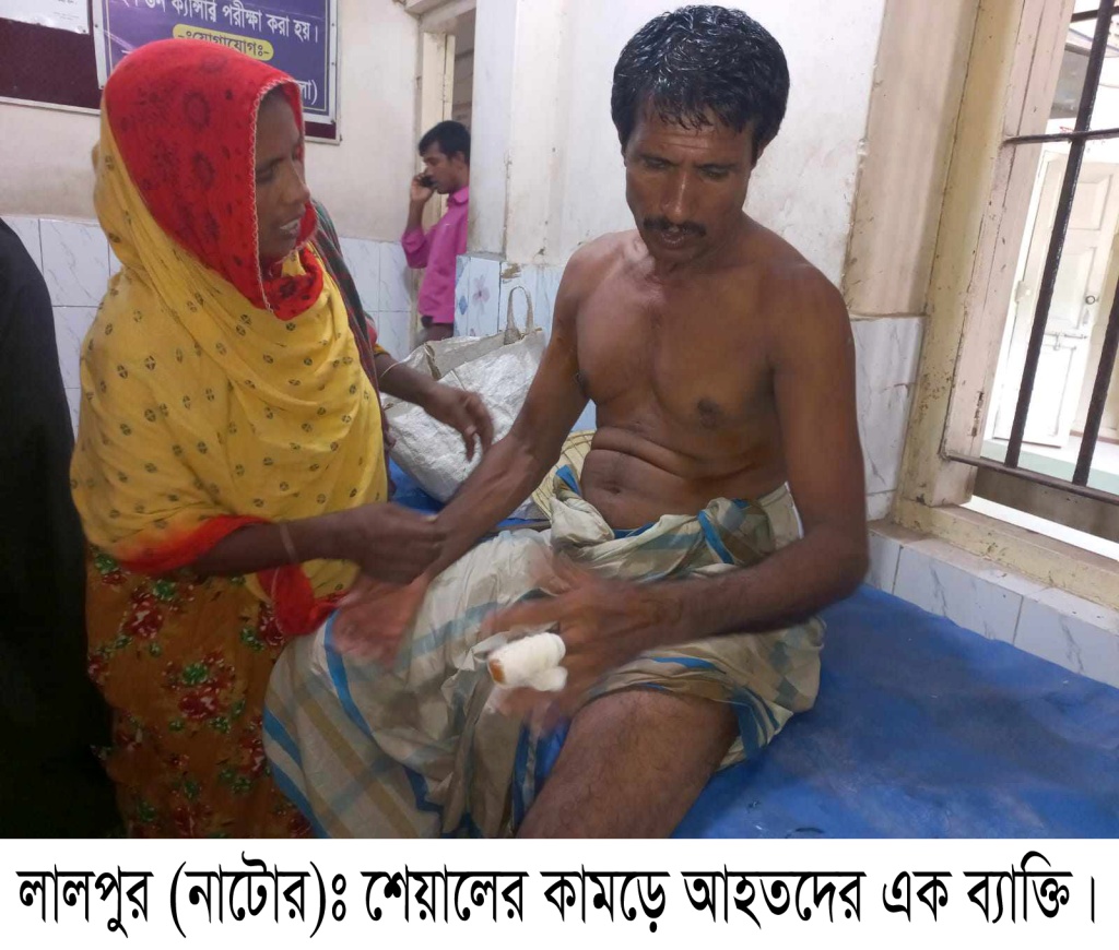 লালপুরে শিয়ালের কামড়ে আহত ৭